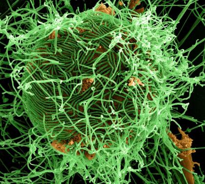 A digitally colorized scanning electron micrograph depiction shows filamentous Ebola virus particles