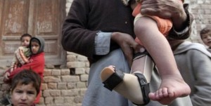 polio-pakistan-ap543