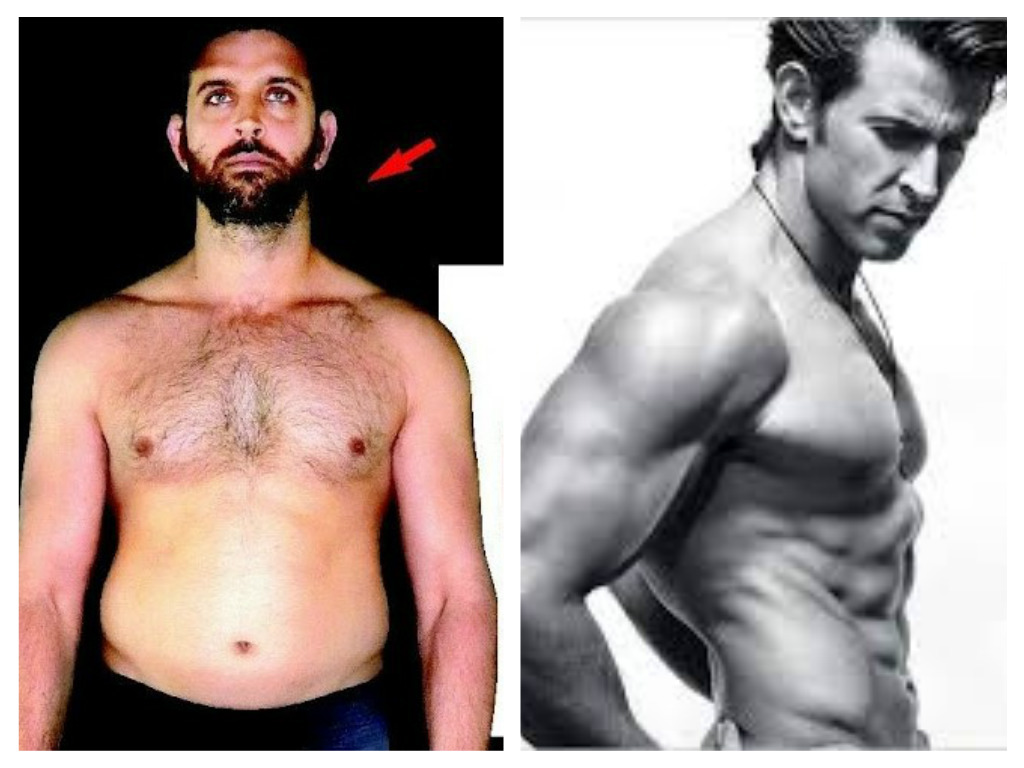 These Shocking Before  After Images of Bollywood Celebrities Are Just  Unbelievable!!