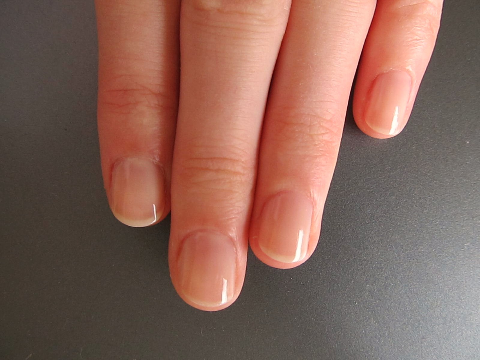 7 Effective Ways to Stop Biting Your Nails - Parhlo 7 Effective Ways to Stop Biting Your Nails - Parhlo