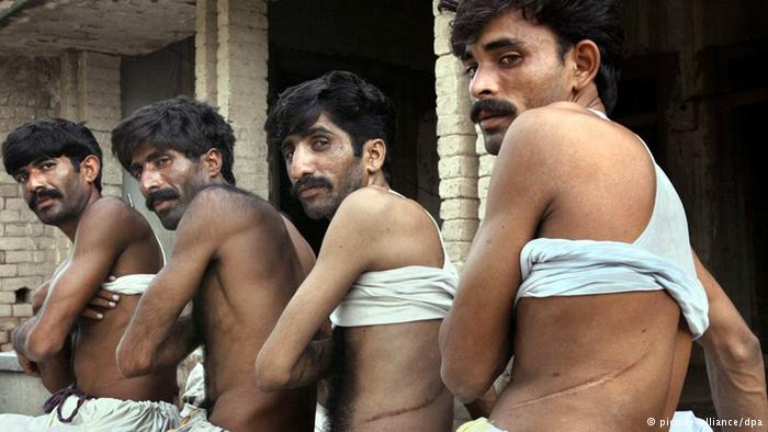 pakistan organ trade