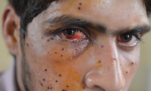 Dear United Nations- India Is The Murderer, Not Pakistan 02