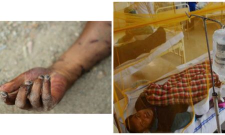 facts about dengue