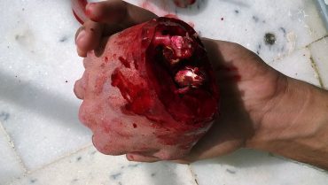 Source: Muhammad Ali SFX Artist