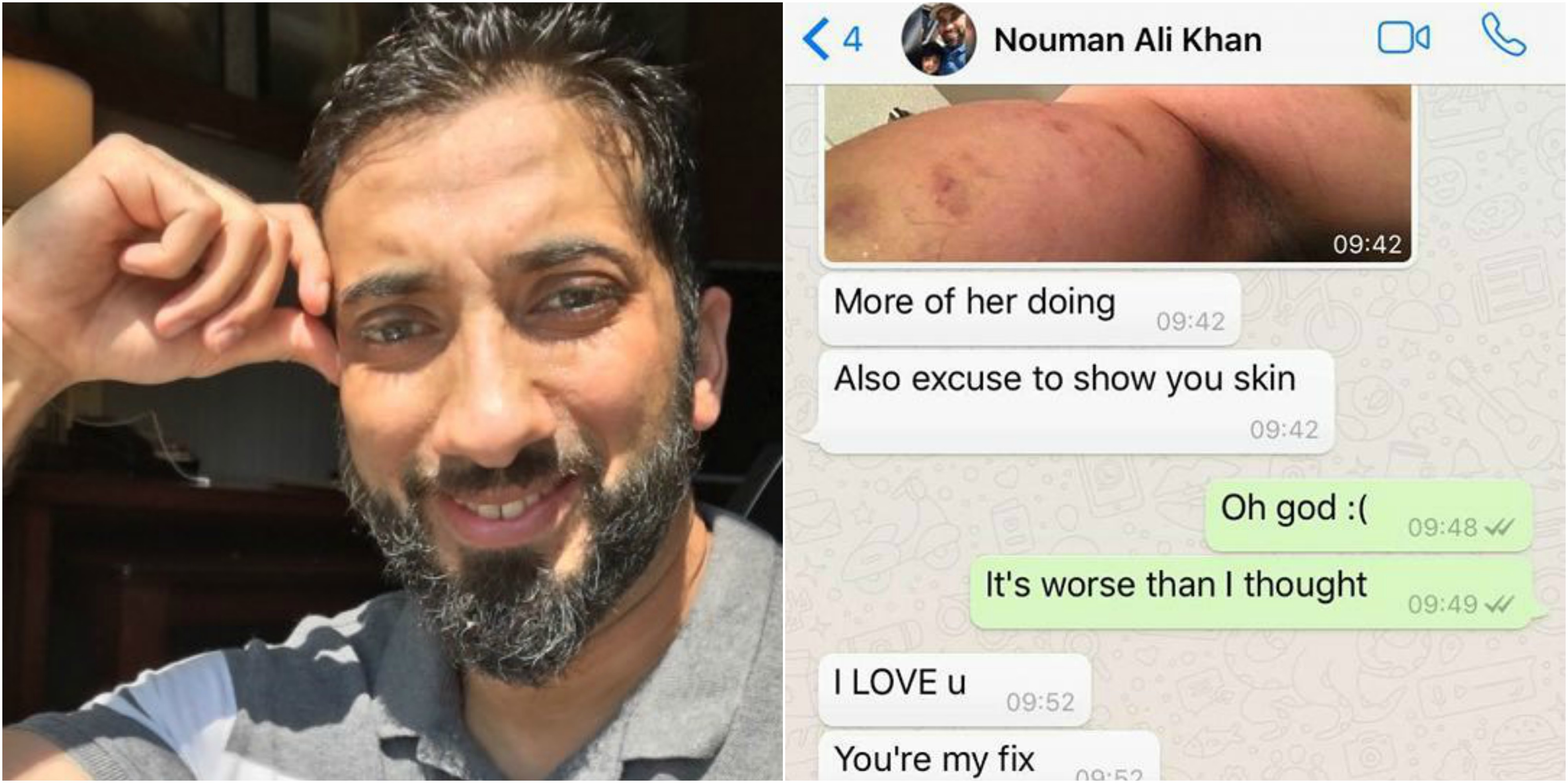 Why did nouman ali khan get divorced