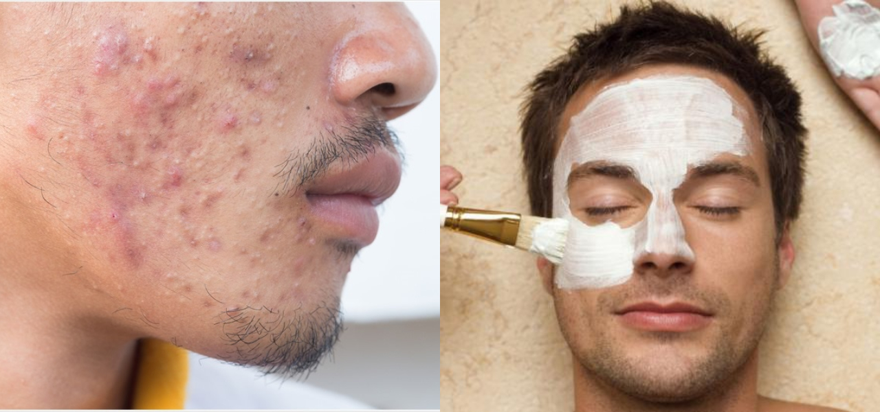 men skin care tips