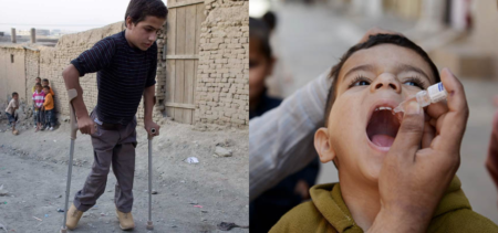 polio