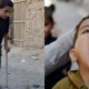 polio
