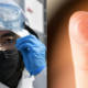 coronavirus glasses lenses