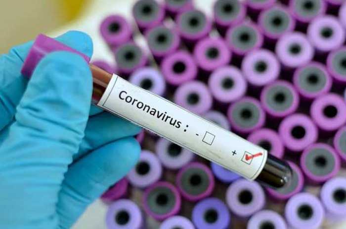 coronavirus impacts pakistan economy