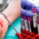 blood donations in pakistan