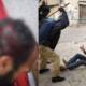 man police brutality FIR