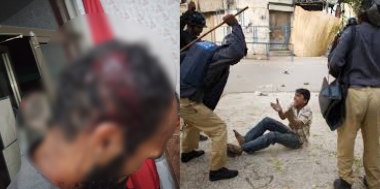 man police brutality FIR