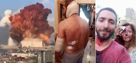 beirut blast survivor lebanese