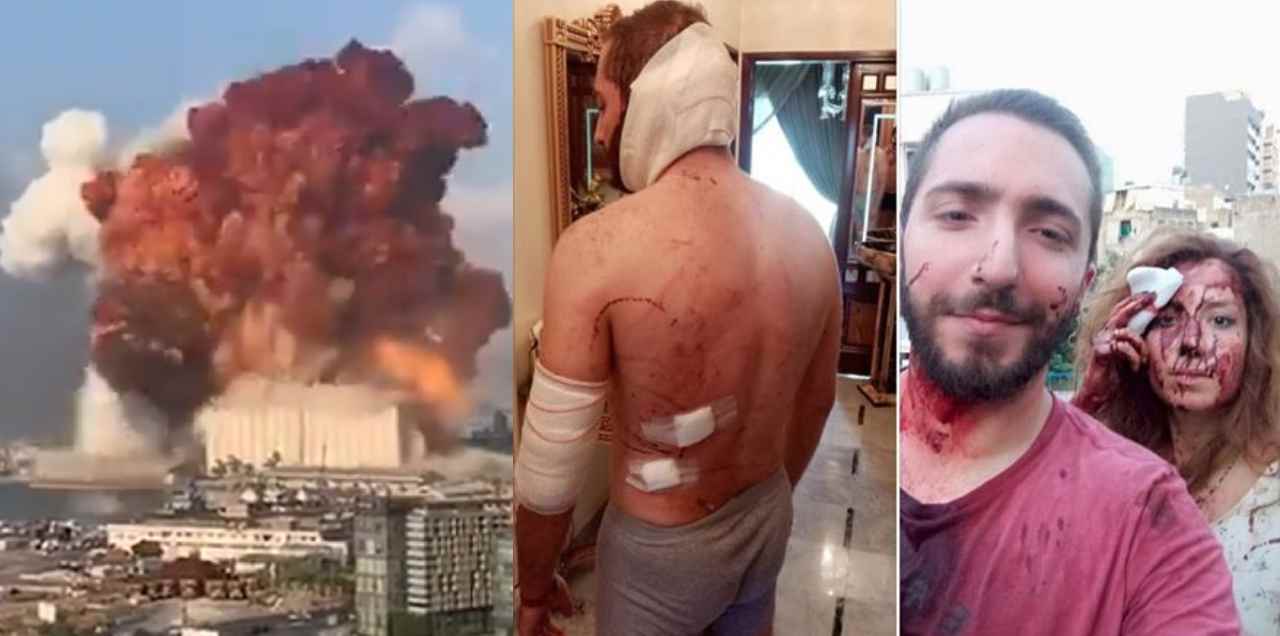 beirut blast survivor lebanese