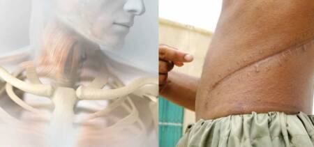 Organ Trafficking