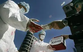 doctor kidney minor girl Quetta