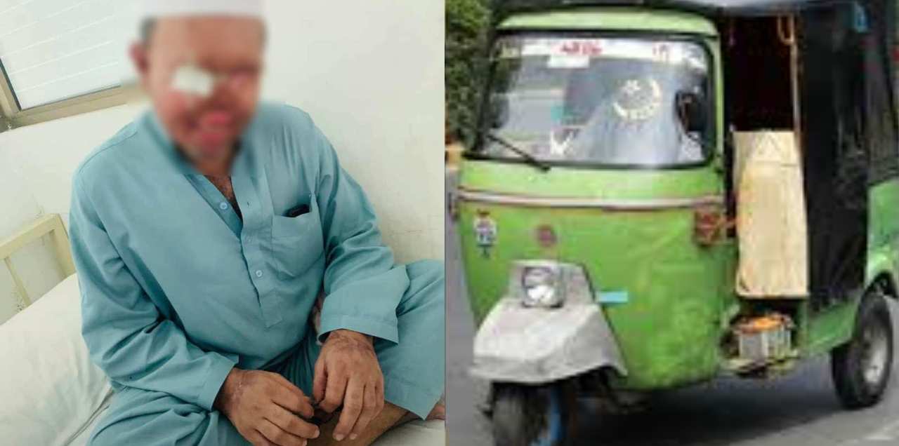 Man Loses eyes saved Women Abusing