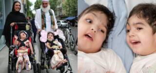 Pakistani Conjoined Twin Sisters