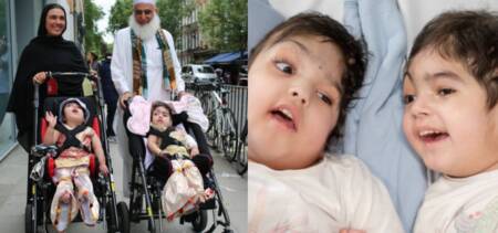 Pakistani Conjoined Twin Sisters