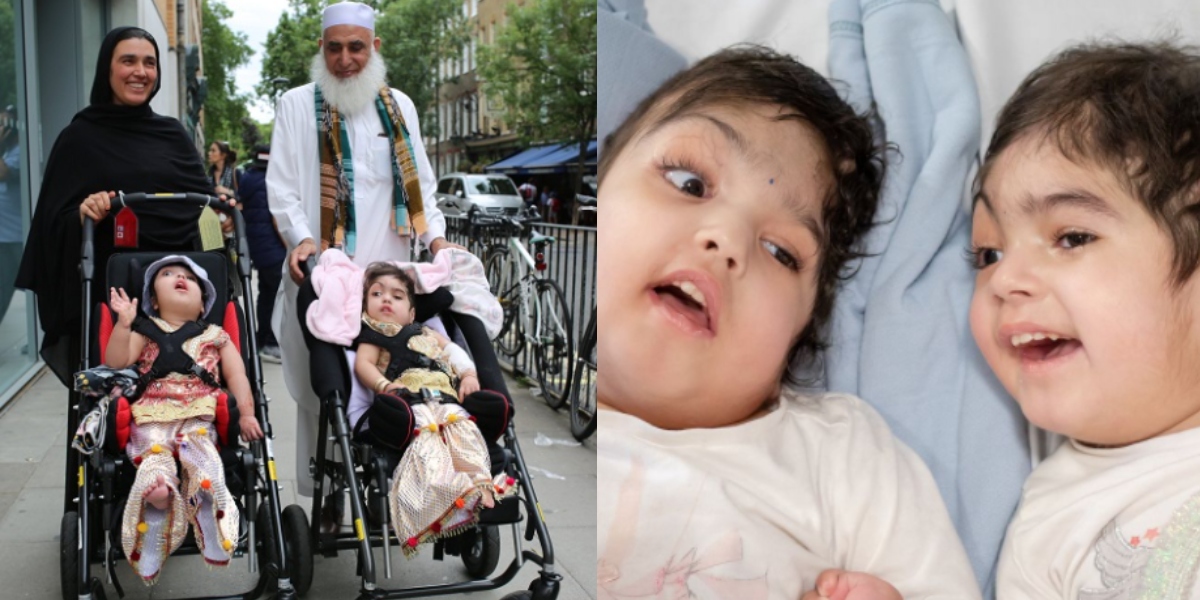 Pakistani Conjoined Twin Sisters