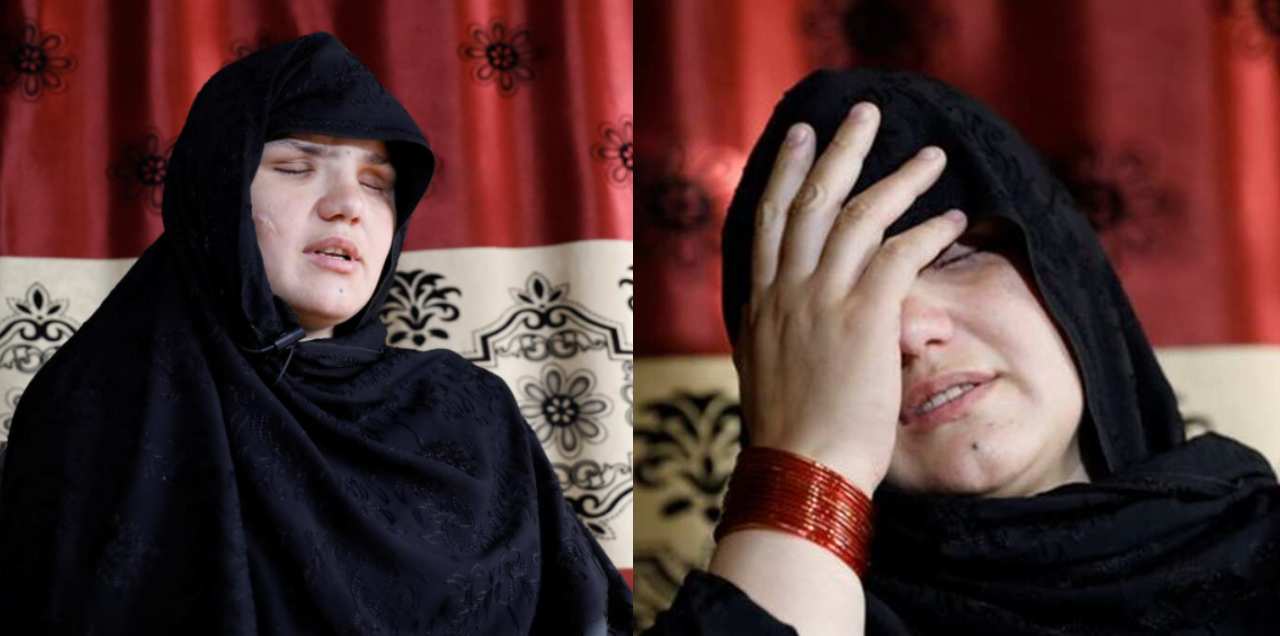 Woman Shot Blinded Getting Job