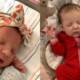 27-years-old baby frozen embryo