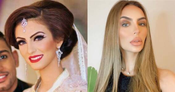 faryal before after