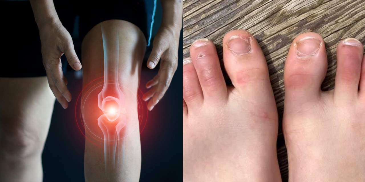 covid-19 new symptoms