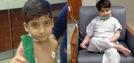 liver transplant