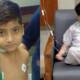 liver transplant