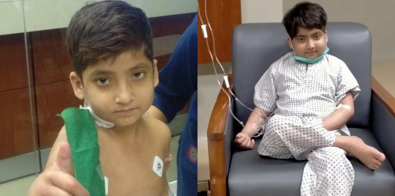 liver transplant