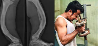pakistani beats Bone Disorder