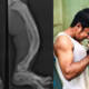pakistani beats Bone Disorder