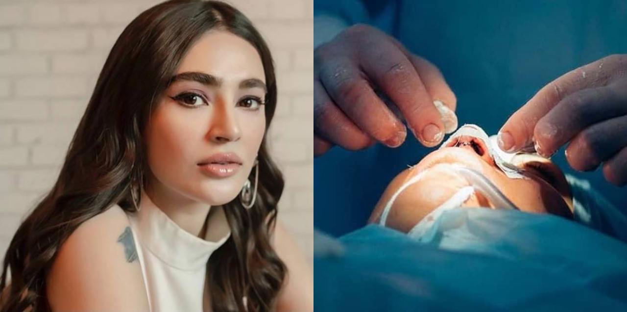 Saheefa Jabbar cosmetic surgery