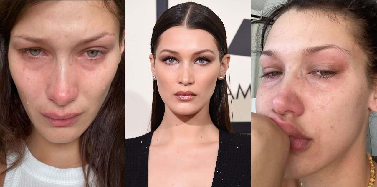 'Social Media Is Not Real' Bella Hadid Bravely Opens Up About