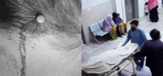 fake peer Hammers Nail Pregnant Woman