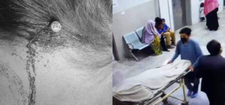 fake peer Hammers Nail Pregnant Woman