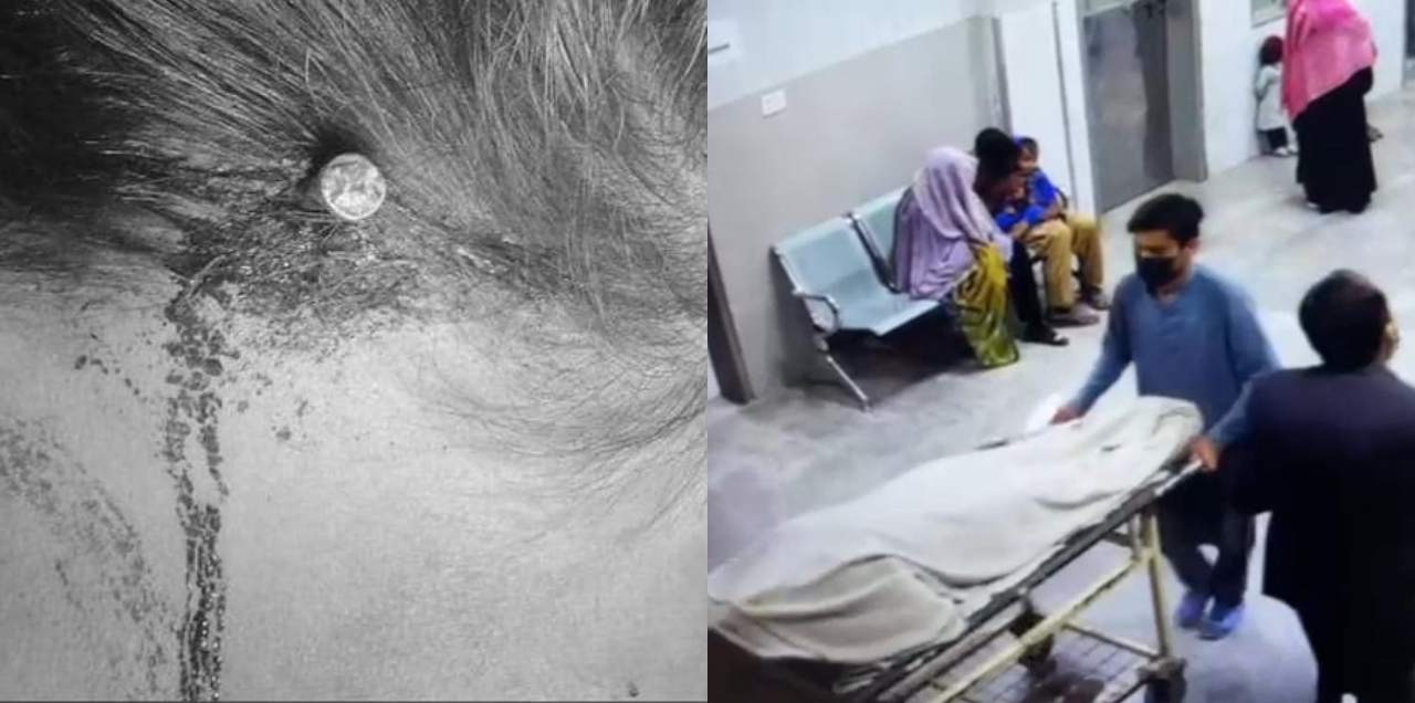 fake peer Hammers Nail Pregnant Woman