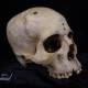 Ancient Egyptians Performed Brain Surgery 4000 Years Ago