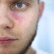 Lupus Disease New Research reveals insights into the Root Cause
