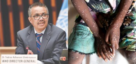 WHO Declares MPox International Health Emergency, NCOC Meeting Called