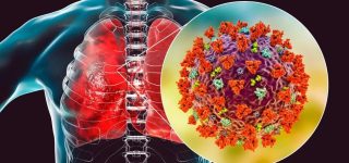 Pakistan Confirms First MERS-CoV Case