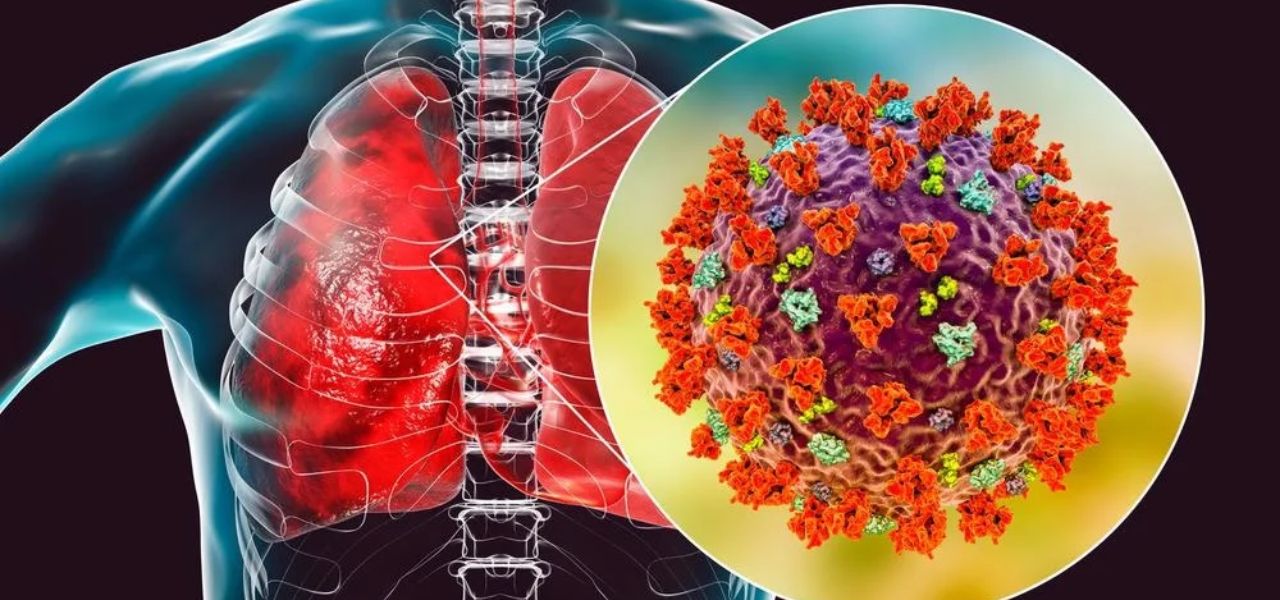 Pakistan Confirms First MERS-CoV Case